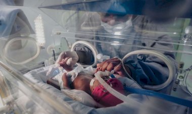 Bebê prematura nascida com 450 gramas recebe tratamento na Maternidade Carmela Dutra