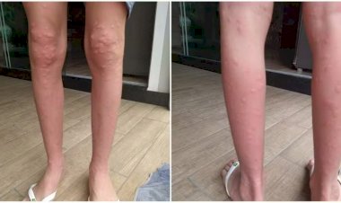 Cidade de SC decreta emergência por causa de infestação de insetos