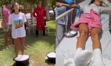 Influenciadores têm queimaduras e são socorridos após ficarem com pés imersos em gelo com sal para reality