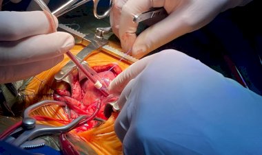 Santa Catarina realiza cirurgia inédita para tratar condição congênita rara em bebê de três meses