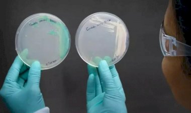 O que é o superfungo detectado em 3 pessoas no Brasil, sem tratamento e fatal